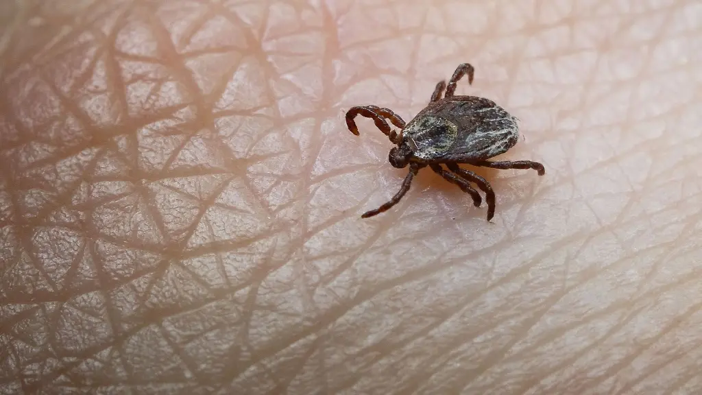 Unerwuenschte-Begegnung-Wer-viel-draussen-unterwegs-ist-kann-den-Kontakt-mit-Zecken-nicht-immer-vermeiden