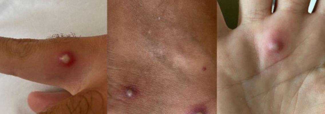 Nur zur redaktionellen Verwendung im Zusammenhang mit der aktuellen Berichterstattung