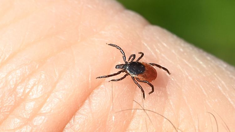 Zeckenbisse können gefährlich sein - wie es um die Träger des ALS-Virus steht, ist noch unklar. Für eine große Gefahr gibt es aber kaum Hinweise.