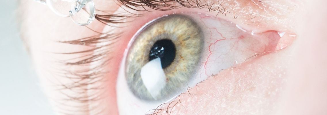 Das Auge ist von feinen Blutgefäßen durchzogen. Dass da mal eines platzt und für ein blutrotes Auge sorgt, lässt sich kaum vermeiden.jpg