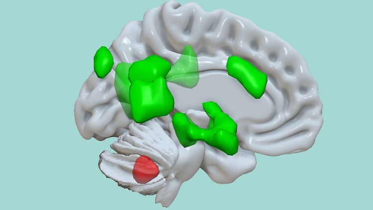Das Kleinhirn (Aktivierung in rot) steht mit verschiedenen Bereichen des Großhirns (Aktivierungen in grün) in Verbindung, um die Abspeicherung emotionaler Information zu verstärken.
