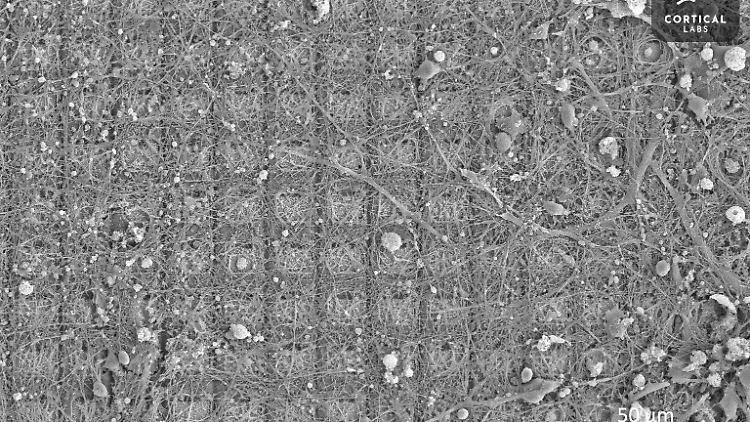 Blick durchs Elektronenmikroskop: Nervenzellen wuchern auf dem Chip.