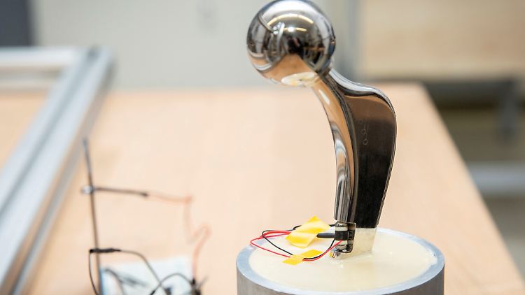 Elektrisch aktive Implantate erzeugen ihren eigenen Strom, was eine Reihe intelligenter Funktionen ermöglichen soll.