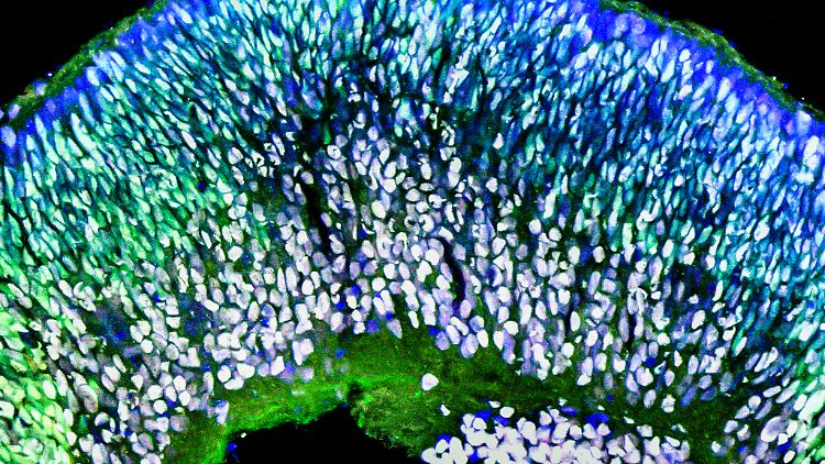 Organoid der Retina (Netzhaut) am 50. Tag seiner Entwicklung in der Petrischale (in vitro). Stammzellen, die sich zu Nervenzellen entwickelt haben, sind mithilfe von Antikörpern weiß gefärbt, Vorläuferzellen der Retina grün.