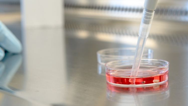 Winzig klein, aber große Hilfe: Hirn-Organoide in einer Petrischale.