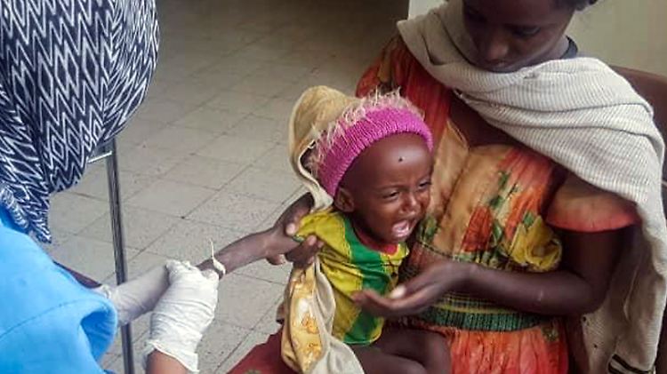 Millionen Menschen, vor allem Kinder leiden unter dem Bürgerkrieg - hier wird ein unterernährtes Kind in Mekele in der Region Tigray behandelt.
