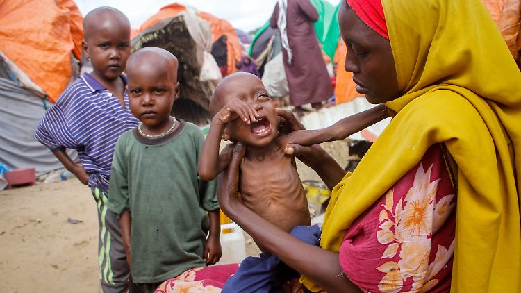 Eine Mutter hält ihre unterernährte Tochter in einem Lager für Vertriebene. Millionen von Menschen in der Region am Horn von Afrika hungern aufgrund der Dürre. Tausende sind bereits gestorben.