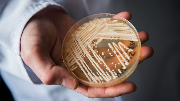 Der Leiter des Nationalen Referenzzentrums für invasive Pilzinfektionen, Oliver Kurzai, mit einer Petrischale mit dem Hefepilz Candida auris: "Wir gehen aktuell mit hoher Sicherheit davon aus, dass es sich um einen realen Anstieg der Fallzahlen handelt."