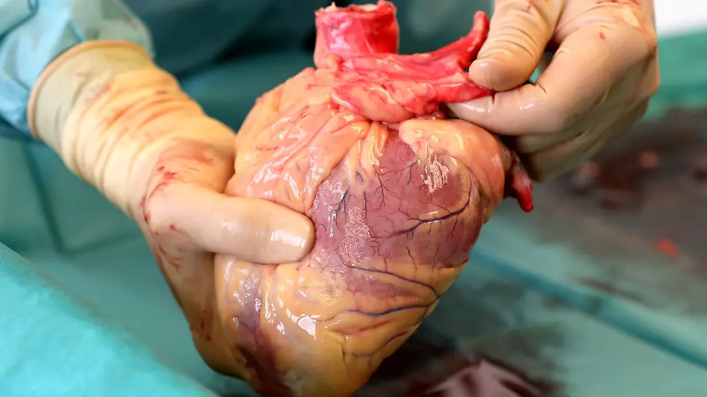 Ein-Transplantationsmediziner-haelt-das-Herz-eines-Verstorbenen-in-den-Haenden-das-kurz-zuvor-entnommen-wurde