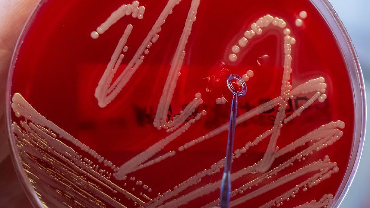 Kulturen des Bakteriums Staphylococcus aureus in einem Labor.