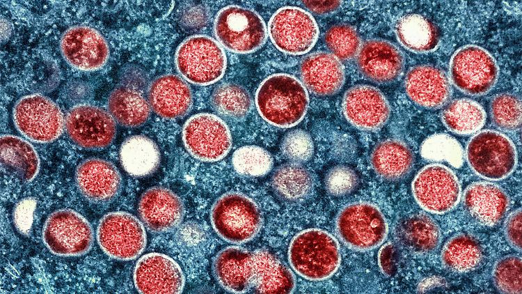 Ein Jahr lang würden noch beide Namen nebeneinander stehen, bevor nur noch "Mpox" verwendet werde, so die WHO.