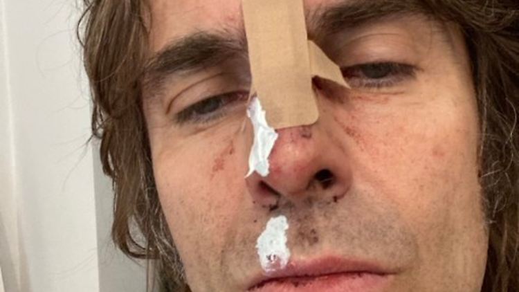 Hätte es 2002 bereits Instagram gegeben, hätte Liam Gallagher vielleicht dieses Bild gepostet - das tat er aber nicht. Diese Aufnahme verbreitete er im September 2021, nachdem er "aus einem Helikopter gefallen" war.