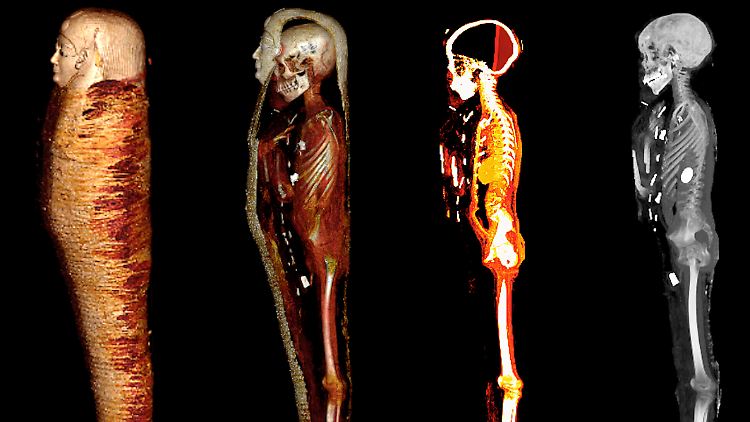 Die Bilder der Computertomografie zeigen das Innere der Mumie "Goldjunge" in vier Schichten.