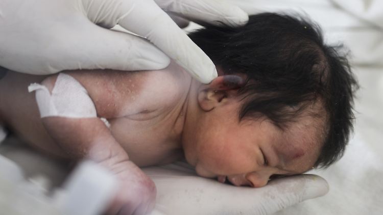 Aja, das "Wunderbaby", bei einer Untersuchung im Krankenhaus. Sie wurde mittlerweile umbenannt und trägt den Namen ihrer Mutter.
