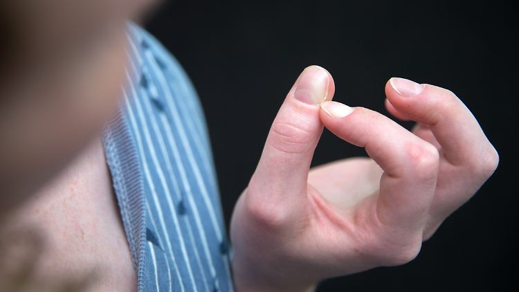 Wenn man nicht aufhören kann, an der Haut rumzupulen, könnte eine psychische Störung namens Skin Picking Disorder vorliegen.