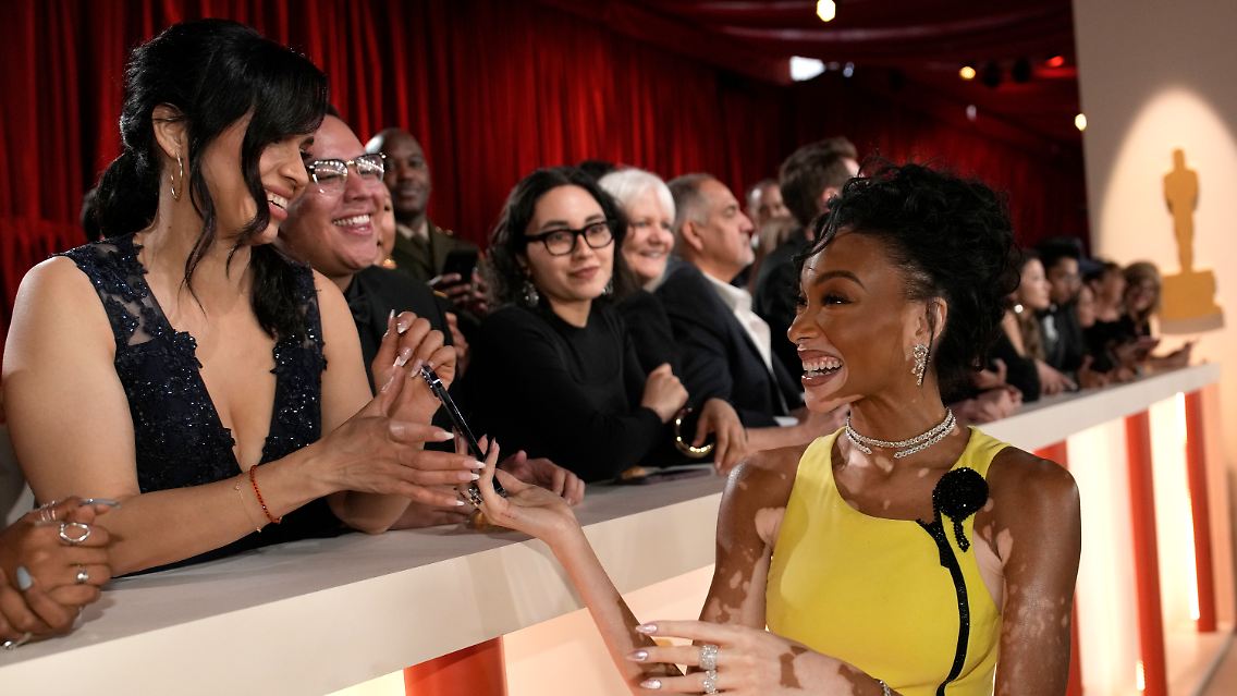 Im gelben Kleid auf dem "Champagner"-Teppich: Winnie Harlow