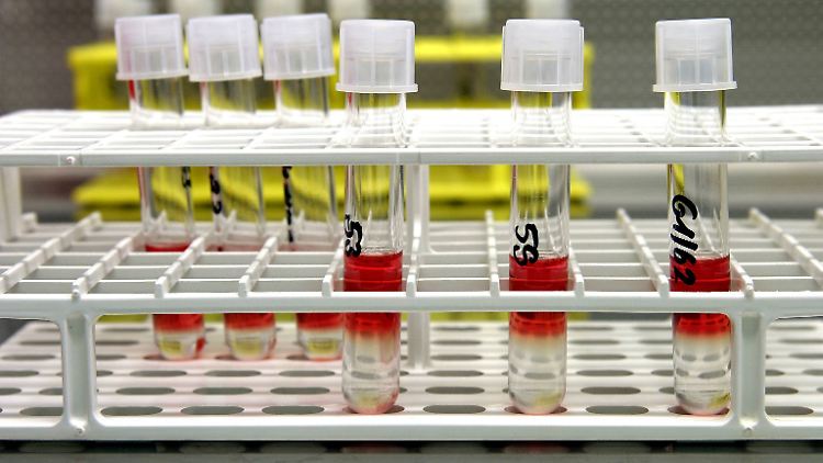 Aus eingelagertem Nabelschnurblut können Stammzellen gewonnen werden.
