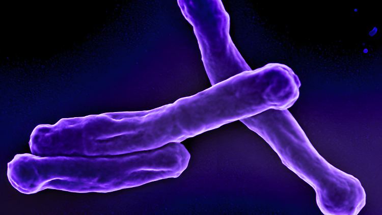 Tuberkulose (TB) ist eine bakterielle Infektionskrankheit, die durch das Bakterium Mycobacterium tuberculosis hervorgerufen wird.