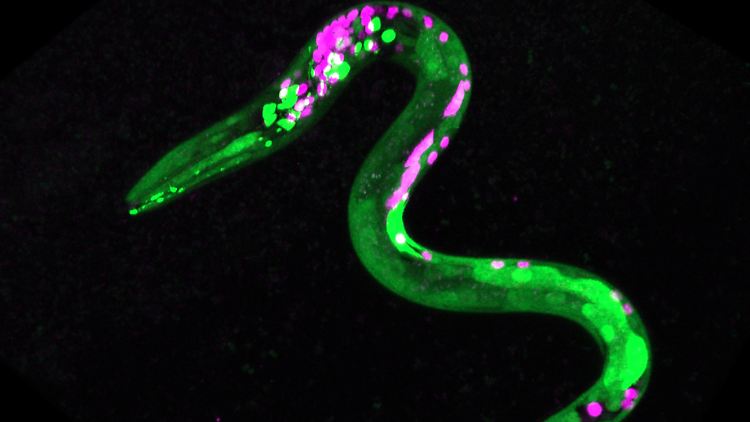 Bild eines Wurms, der gentechnisch so verändert wurde, dass bestimmte Neuronen und Muskeln fluoreszierend sind. Grüne Punkte: Neuronen, die auf Cannabinoide reagieren. Magentafarbene Punkte: andere Neuronen.