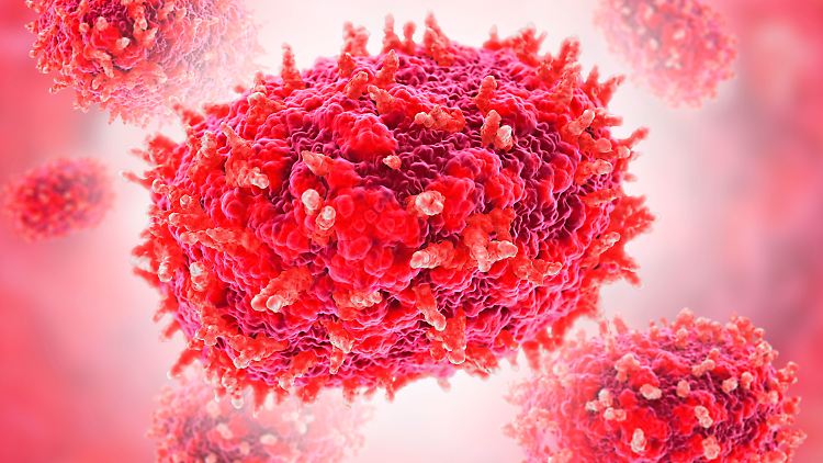 Mpox unterm Mikroskop: Bis heute gilt wegen des Virus ein Gesundheitsnotstand - der höchste Alarm, den die WHO verhängen kann. 