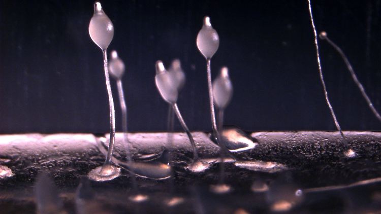 Die Amöbe Dictyostelium discoideum in mikroskopischer Auflösung.