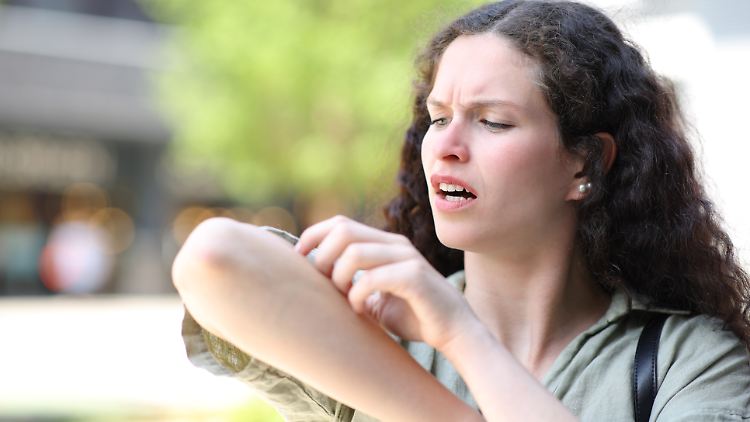 Unangenehme Insektenstiche gehören zum Sommer dazu, doch gegen Juckreiz und Rötungen gibt es Hilfe. 
