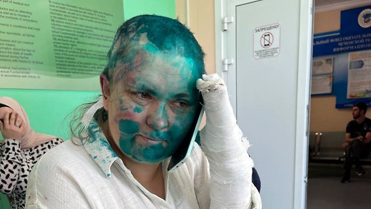 Die Angreifer haben Elena Milaschina den Kopf rasiert und sie mit Farbe übergossen.
