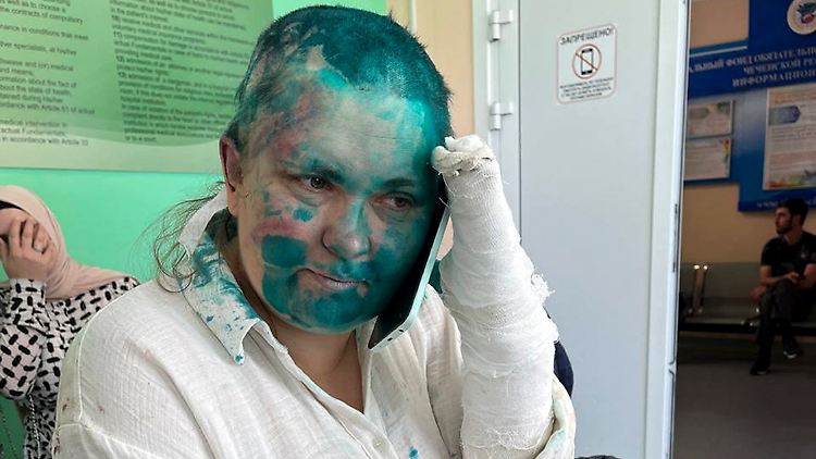 Die russische Investigativ-Reporterin Jelena Milaschina wurde am Dienstag in der russischen Kaukasus-Republik Tschetschenien zusammengeschlagen und schwer verletzt. Die Angreifer rasierten ihr die Haare ab und übergossen sie mit grünem Färbemittel.