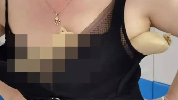 Die Frau war durch ihre seltsame Figur aufgefallen.