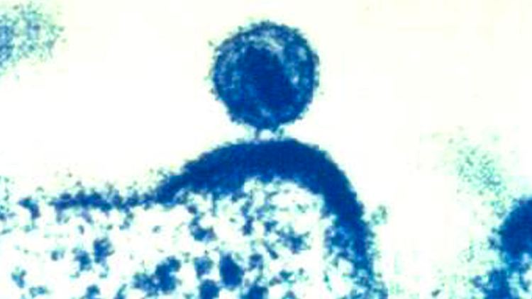 Dieses kolorierte Elektronenmikroskopbild zeigt ein einzelnes humanes Immundefizienzvirus. 