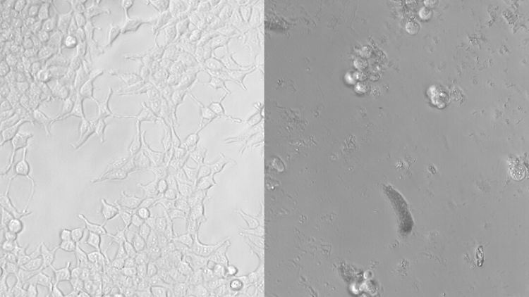 Die mikroskopischen Aufnahmen zeigen die Nierenzellen am Anfang (l) und nach 72 Stunden mit Mikro- und Nanoplastik.