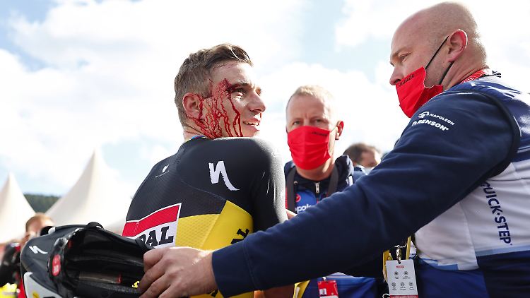 Evenepoel blutete nach dem Crash im Ziel stark.