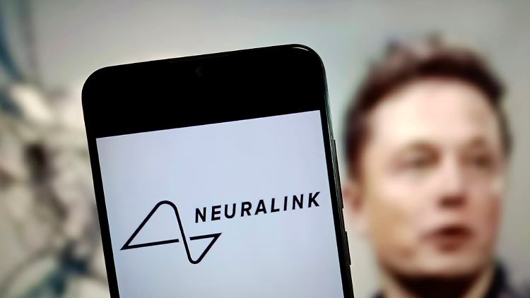 Ein Implantat soll bei Patienten mit Lähmungen aufgrund von Rückenmarksverletzungen oder amyotropher Lateralsklerose erprobt werden.