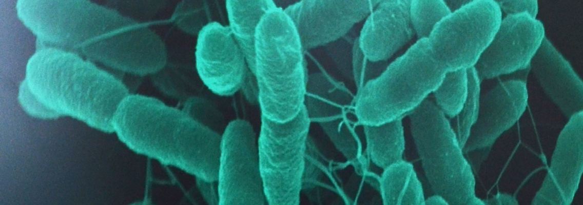 Pseudomonas putida.jpg