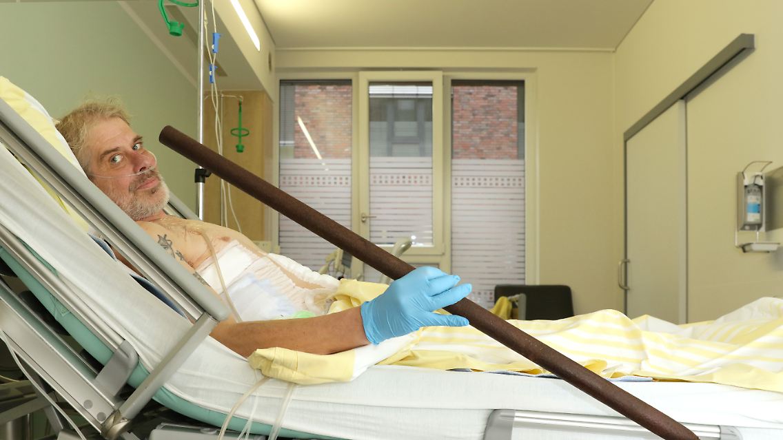 Diese rostige Stange hatte den Körper des 55-Jährigen durchbohrt. Gute Besserung!