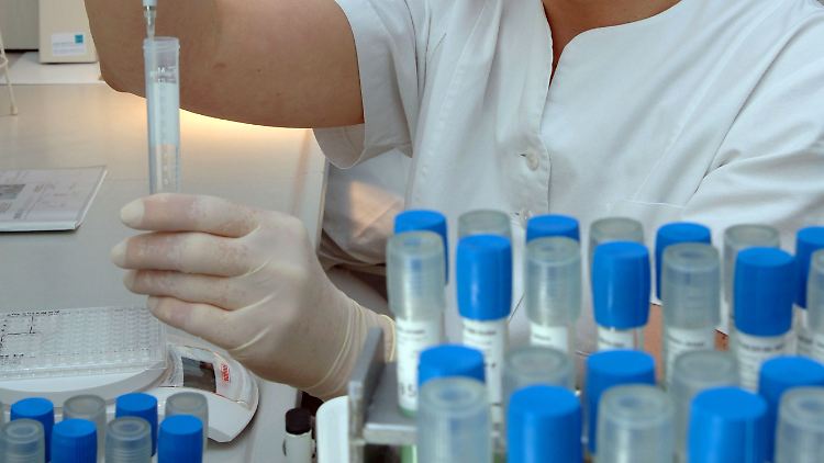 Tuberkulose-Kontrolltests im Labor.