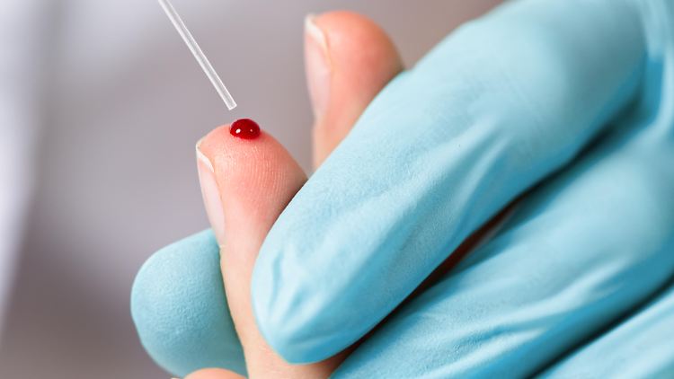 Ab 25 Jahren sollen systematisch unter anderem die Cholesterinwerte ermittelt werden.