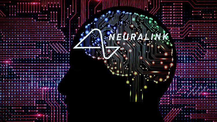 Einem Patienten hat Neuralink bisher einen Chip eingesetzt.