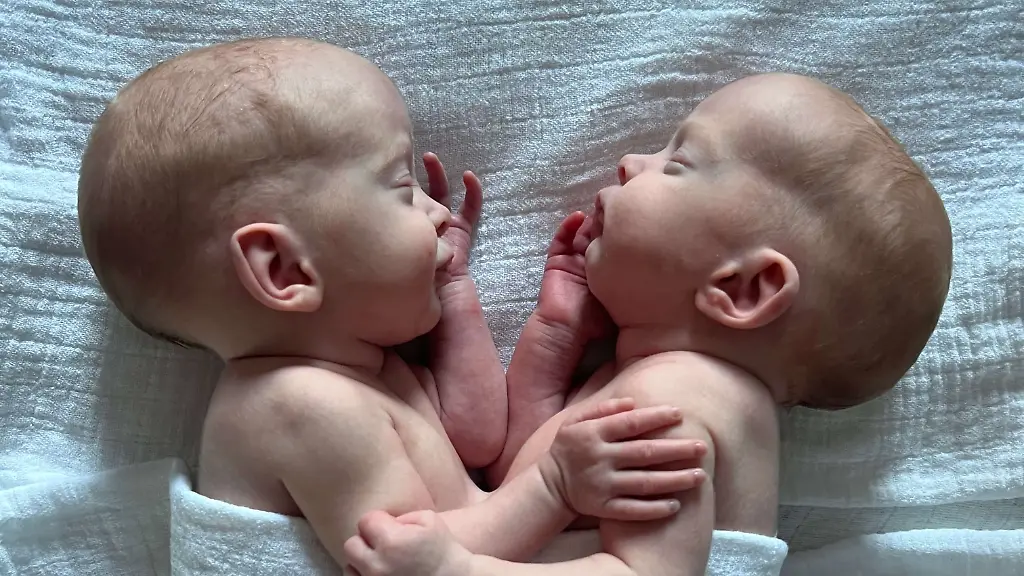 zwillinge-verbunden-2-1