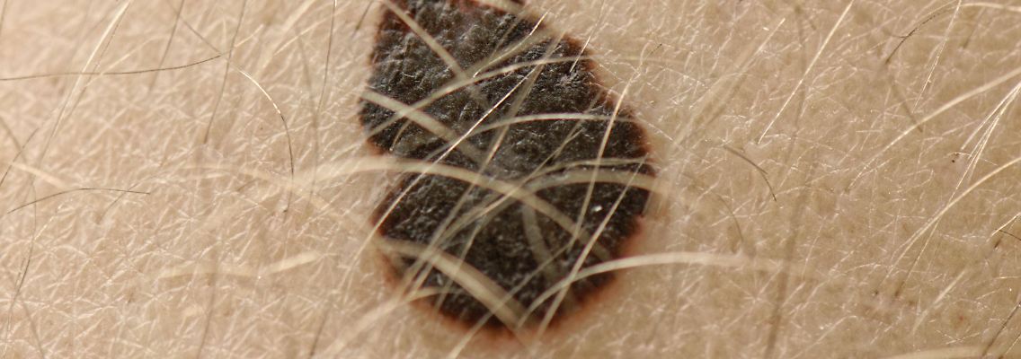 imago0091772560h.jpg