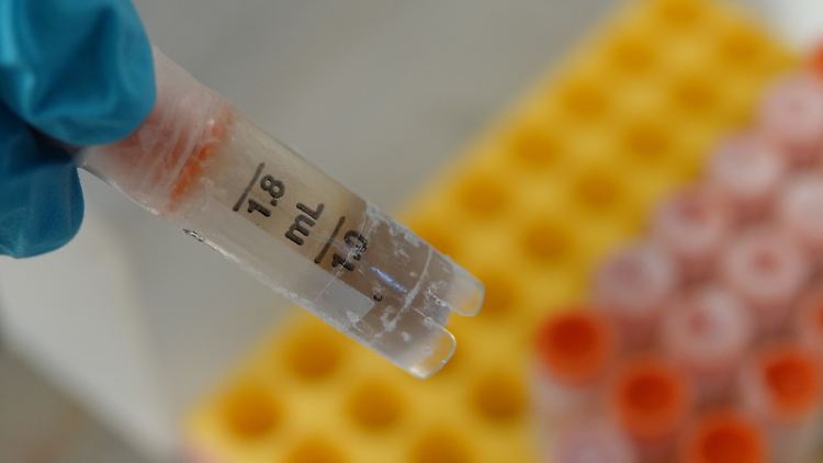 Eingefrorene Stuhlprobe in einem Gläschen: Schweizer Wissenschaftler wollen einen Tresor für Darmbakterien aus aller Welt anlegen.
