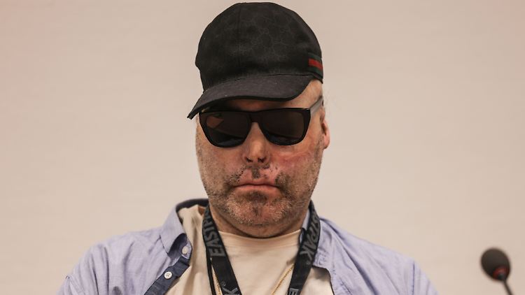 Von seinem Unfall schwer gezeichnet: Niko Brenner alias Dr. Knarf.