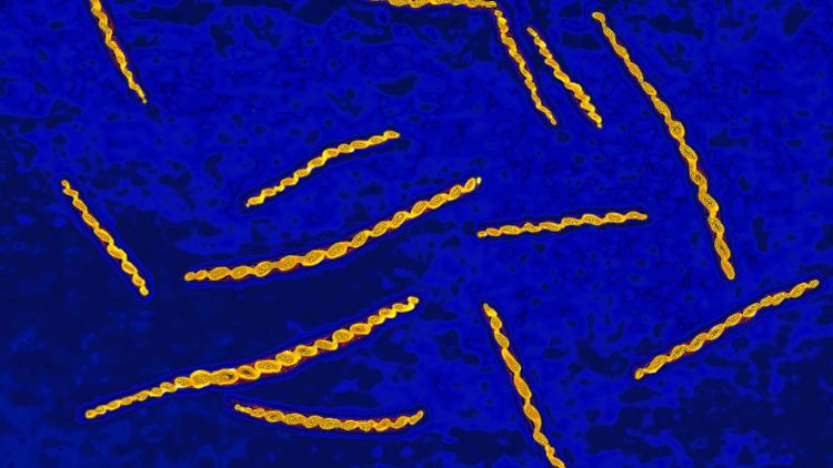 Unter dem Mikroskop lässt sich die Spiralform des Syphilis-Bakteriums Treponema pallidum gut erkennen.