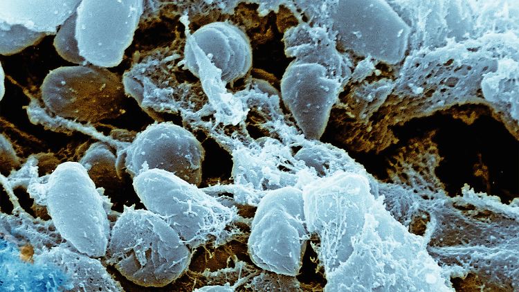 Das Bakterium Yersinia pestis löst die Beulenpest aus.