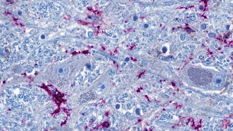 Nervenzellen (graublau) stehen eng mit hirneigenen Immunzellen (lila) in Kontakt. Die blauen fadenförmigen Strukturen sind Fortsätze der Nervenzellen, die als Nervenfasern bis in weit entfernte Organe hineinreichen können.
