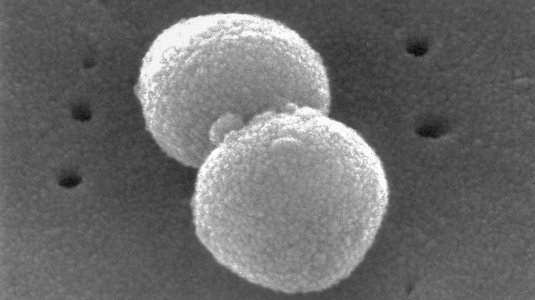 Eine mikroskopische Aufnahme von Streptococcus pneumoniae. 