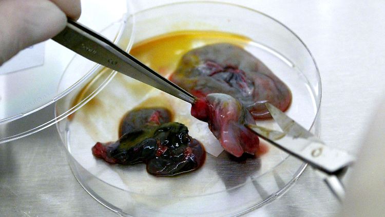 Organproben eines erkrankten Huhnes im Labor - Vögel übertragen die Ornithose an Menschen.