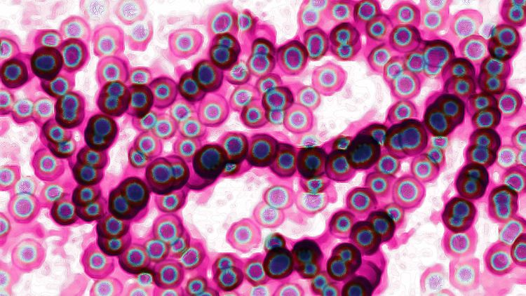 Das Bakterium Streptococcus pyogenes unter dem Mikroskop.
