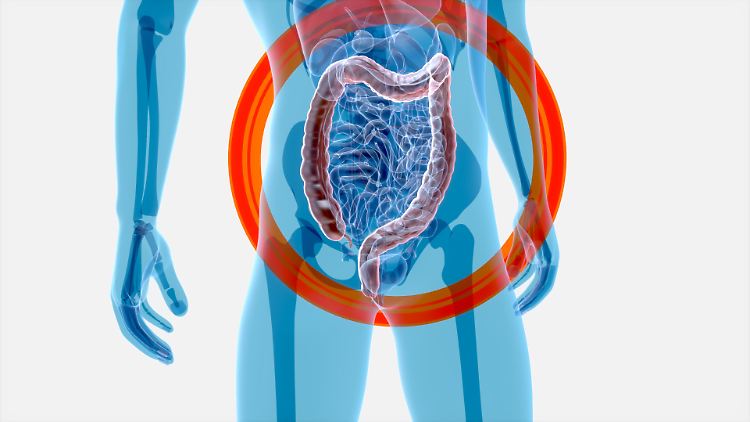 Derzeit geht die Wissenschaft davon aus: Je mehr verschiedene Bakterien sich im Darm befinden, umso besser für die Gesundheit. 