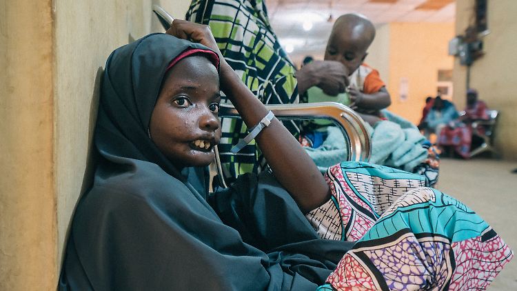 Die 18-jährige Amina leidet als Folge der Infektion an einer Kiefersperre und wird in ihrem Heimatort diskriminiert.